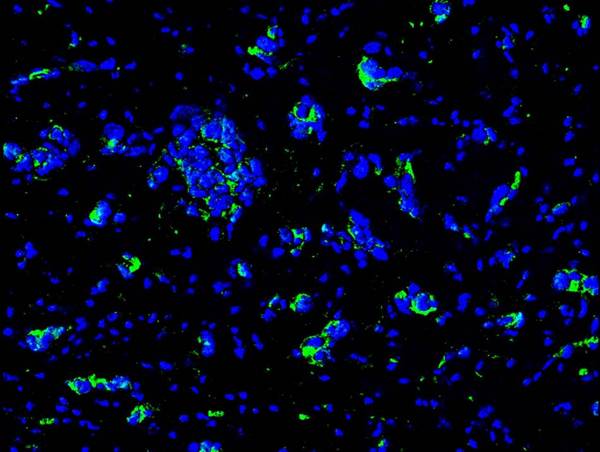 Image kindly submitted by Victor Blanco as part of the Free Sample Program. Frozen mouse brain probed with bs-0170R at 1:100, overnight at 4C.