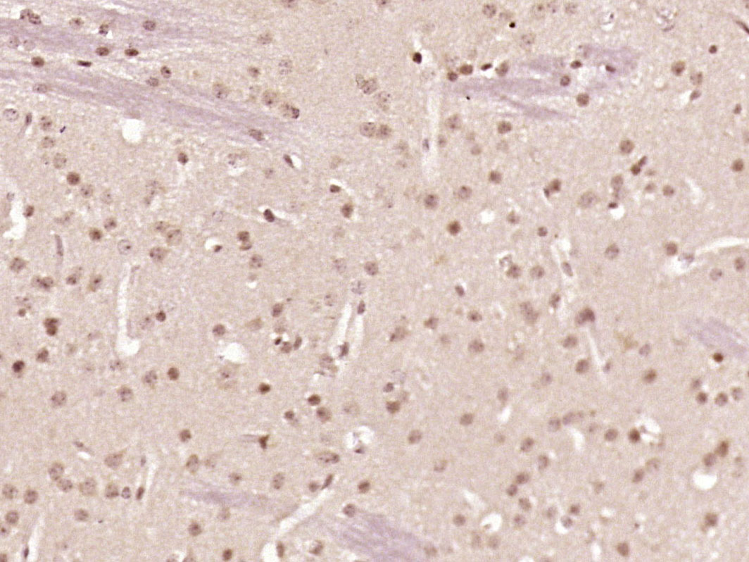 Paraformaldehyde-fixed, paraffin embedded mouse brain; Antigen retrieval by boiling in sodium citrate buffer (pH6.0) for 15min; Block endogenous peroxidase by 3% hydrogen peroxide for 20 minutes; Blocking buffer (normal goat serum) at 37°C for 30min; Antibody incubation with ZNF312 Polyclonal Antibody, Unconjugated (bs-12148R) at 1:500 overnight at 4°C, followed by a conjugated secondary for 20 minutes and DAB staining.