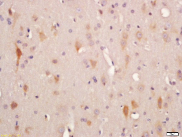 Formalin-fixed and paraffin embedded rat brain labeled with Rabbit Anti-ADCY10 Polyclonal Antibody, Unconjugated (bs-3916R) at 1:200 followed by conjugation to the secondary antibody and DAB staining\\n