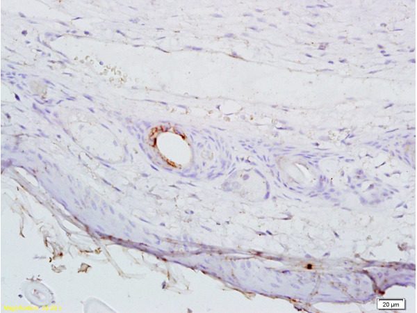 Formalin-fixed and paraffin embedded mouse cancer tissue labeled with Anti-AGPAT4 Polyclonal Antibody, Unconjugated (bs-5033R) at 1:200 followed by conjugation to the secondary antibody, (SP-0023), and DAB staining