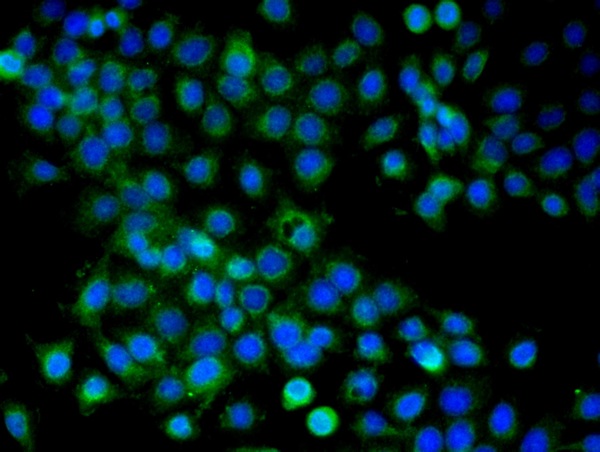 Validation submitted by One World Lab. A431 cells were stained with ARMC3 Polyclonal Antibody, Unconjugated (bs-7969R) at 1:100 in PBS and incubated for one hour at room temperature, followed by secondary antibody incubation, DAPI staining of the nuclei and detection.
