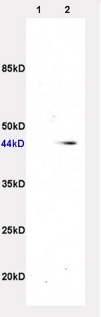 L1 rat liver and L2 rat brain lysates, probed: ADRB3 (bs-01063R) at 1:200 in 4˚C. Followed by conjugation to secondary antibody (bs-0295G-HRP) at 1:3000 90min in 37˚C. Predicted 44kD and observed band size:44kD.