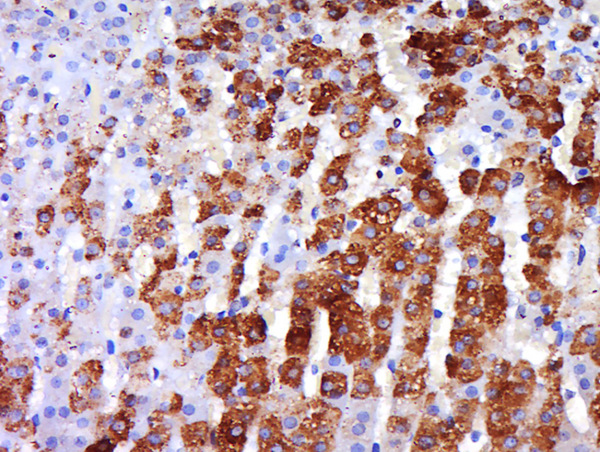 Paraformaldehyde-fixed, paraffin embedded rat adrenal gland; Antigen retrieval by boiling in sodium citrate buffer (pH6) for 15min; Block endogenous peroxidase by 3% hydrogen peroxide for 30 minutes; Blocking buffer (normal goat serum) at 37°C for 20min; Antibody incubation with Rabbit Anti-beta 3 Adrenergic Receptor Polyclonal Antibody, Unconjugated (bs-1063R) at 1:500 overnight at 4°C, followed by a conjugated secondary and DAB staining.