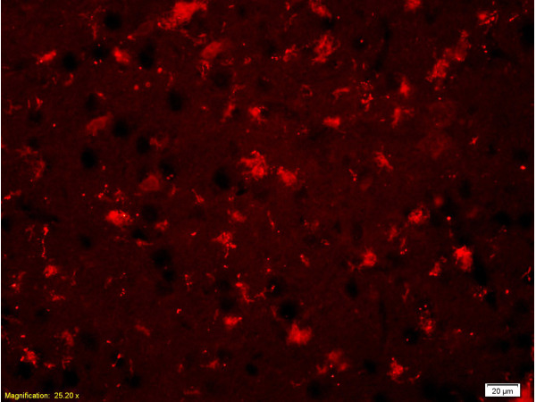 Formalin-fixed and paraffin-embedded rat brain labeled with Anti-BNP Polyclonal Antibody, Unconjugated(bs-2207R) 1:200, overnight at 4°C, The secondary antibody was Goat Anti-Rabbit IgG, Cy3 conjugated(bs-0295G-Cy3)used at 1:200 dilution for 40 minutes at 37°C.