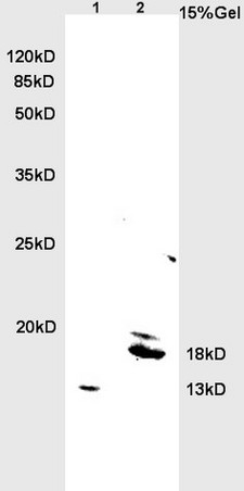 L1 rat brain lysates L2 rat heart lysates probed with Anti BNP Polyclonal Antibody, Unconjugated (bs-2207R) at 1:200 overnight at 4˚C. Followed by conjugation to secondary antibody (bs-0295G-HRP) at 1:3000 for 90 min at 37˚C. Predicted band 13kD. Observed band size:13kD, 18kD.\\n