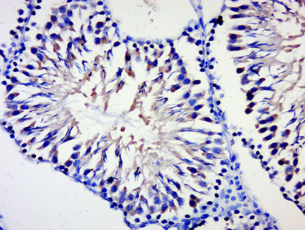Paraformaldehyde-fixed, paraffin embedded rat testis; Antigen retrieval by boiling in sodium citrate buffer (pH6) for 15min; Block endogenous peroxidase by 3% hydrogen peroxide for 30 minutes; Blocking buffer (normal goat serum) at 37°C for 20min; Antibody incubation with \\tBPTF/FALZ Polyclonal Antibody, Unconjugated (bs-11641R) at 1:500 overnight at 4°C, followed by a conjugated secondary and DAB staining.