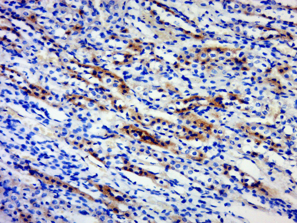 Paraformaldehyde-fixed, paraffin embedded rat kidney; Antigen retrieval by boiling in sodium citrate buffer (pH6) for 15min; Block endogenous peroxidase by 3% hydrogen peroxide for 30 minutes; Blocking buffer (normal goat serum) at 37°C for 20min; Antibody incubation with \\tBPTF/FALZ Polyclonal Antibody, Unconjugated (bs-11641R) at 1:500 overnight at 4°C, followed by a conjugated secondary and DAB staining.