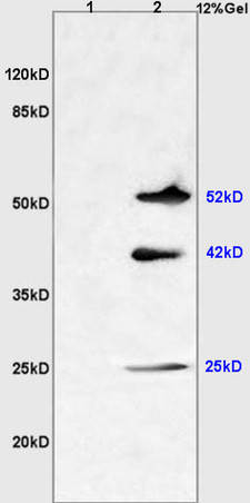 L1 mouse liver lysates L2 mouse brain lysates probed with Anti NGX6/C9orf127 Polyclonal Antibody, Unconjugated (bs-1065R) at 1:200 overnight at 4˚C. Followed by conjugation to secondary antibody (bs-0295G-HRP) at 1:3000 for 90 min at 37˚C. Predicted band 52kD. Observed band size:52kD,42kD,25kD\\n