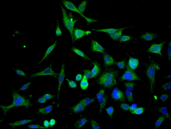 Image provided by One World Lab validation program. A549 cells probed with Rabbit Anti-Cathepsin L Polyclonal Antibody (bs-1508R) at 1:50 for 60 minutes at room temperature followed by Goat Anti-Rabbit IgG (H+L) Alexa Fluor 488 Conjugated secondary antibody.