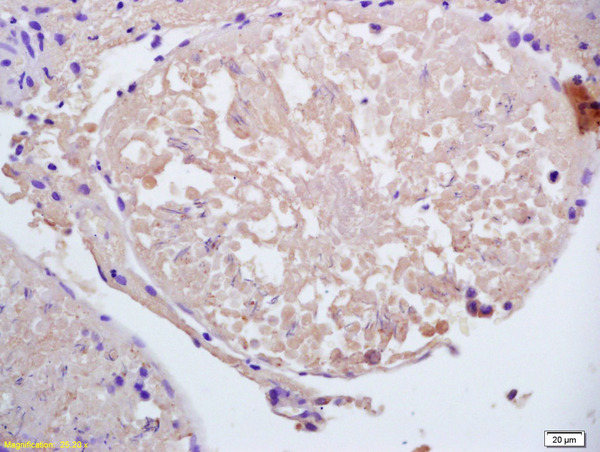 Formalin-fixed and paraffin embedded rat testis labeled with Anti-CCDC11 Polyclonal Antibody, Unconjugated (bs-7740R) at 1:200 followed by conjugation to the secondary antibody and DAB staining.