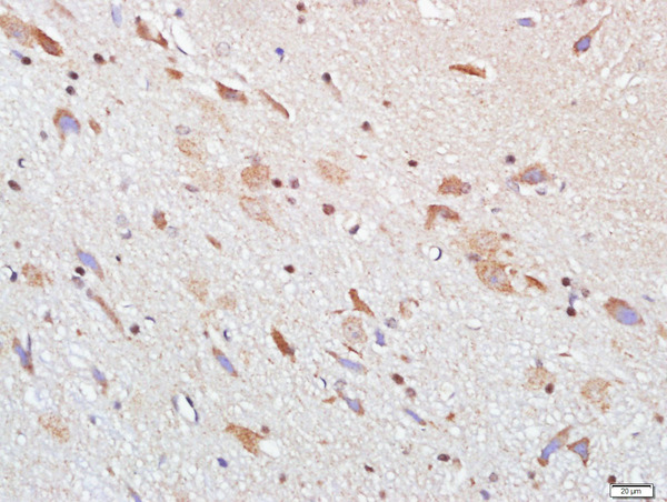 Paraformaldehyde-fixed, paraffin embedded rat brain; Antigen retrieval by boiling in sodium citrate buffer (pH6.0) for 15min; Block endogenous peroxidase by 3% hydrogen peroxide for 20 minutes; Blocking buffer (normal goat serum) at 37°C for 30min; Antibody incubation with CNGB1 Polyclonal Antibody, Unconjugated (bs-11332R) at 1:400 overnight at 4°C, followed by a conjugated secondary (sp-0023) for 20 minutes and DAB staining
