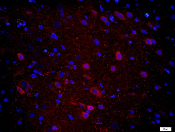 Paraformaldehyde-fixed, paraffin embedded rat brain tissue; Antigen retrieval by boiling in sodium citrate buffer(pH6) for 15min; Block endogenous peroxidase by 3% hydrogen peroxide for 30 minutes; Blocking buffer (normal goat serum) at 37°C for 20min; Antibody incubation with Rabbit Anti-CPLX1 Polyclonal Antibody, Unconjugated (bs-11341R) at 1:400 overnight at 4°C, followed by a conjugated secondary and DAPI staining