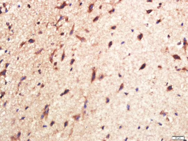 Paraformaldehyde-fixed, paraffin embedded mouse brain tissue; Antigen retrieval by boiling in sodium citrate buffer(pH6) for 15min; Block endogenous peroxidase by 3% hydrogen peroxide for 30 minutes; Blocking buffer (normal goat serum) at 37°C for 20min; Antibody incubation with Rabbit Anti-CPLX1 Polyclonal Antibody, Unconjugated (bs-11341R) at 1:400 overnight at 4°C, followed by a conjugated secondary and DAB staining
