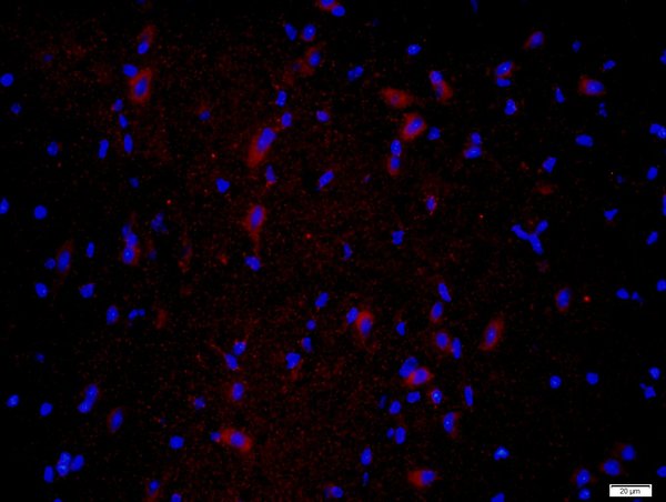 Paraformaldehyde-fixed, paraffin embedded tissue; Antigen retrieval by boiling in sodium citrate buffer(pH6) for 15min; Block endogenous peroxidase by 3% hydrogen peroxide for 30 minutes; Blocking buffer (normal goat serum) at 37°C for 20min; Antibody incubation with Rabbit Anti-CPLX1 Polyclonal Antibody, Unconjugated (bs-11341R) at 1:400 overnight at 4°C, followed by a conjugated secondary and DAB staining