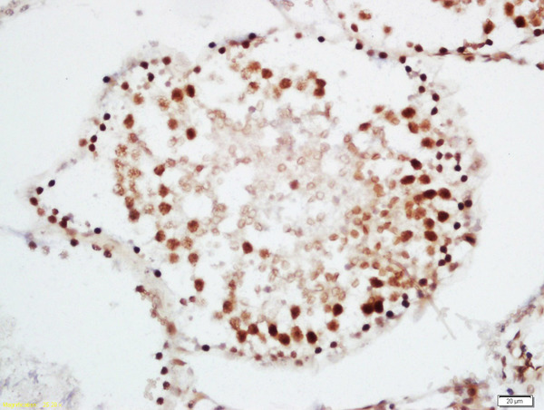 Formalin-fixed and paraffin embedded rat testis labeled with Rabbit Anti-CRNKL1 Polyclonal Antibody, Unconjugated (bs-14065R) at 1:200 followed by conjugation to the secondary antibody and DAB staining