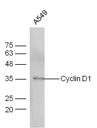 A549 cells probed with Anti-Cyclin D1 Polyclonal Antibody (bs-0623R) at 1:300 overnight in 4˚C. Followed by conjugation to the secondary antibody (bs-0295G-HRP) at 1:5000 90min in 37˚C.