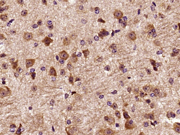 Paraformaldehyde-fixed, paraffin embedded mouse brain; Antigen retrieval by boiling in sodium citrate buffer (pH6) for 15min; Block endogenous peroxidase by 3% hydrogen peroxide for 30 minutes; Blocking buffer (normal goat serum) at 37°C for 20min; Antibody incubation with DCTN3 Polyclonal Antibody (bs-7746R) at 1:400 overnight at 4°C, followed by a conjugated secondary and DAB staining