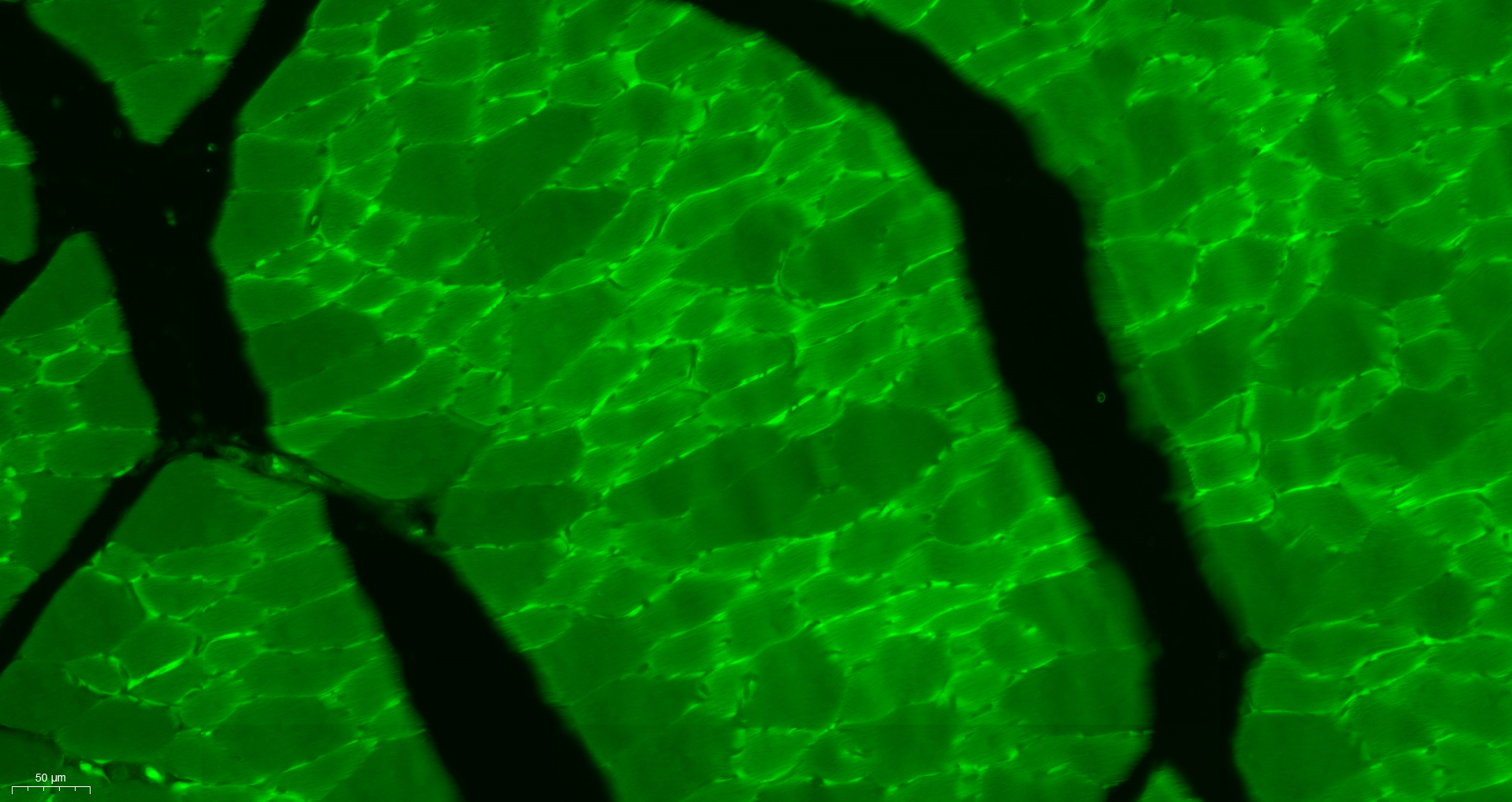 Paraformaldehyde-fixed, paraffin embedded Rat skeletal muscle; Antigen retrieval by boiling in sodium citrate buffer (pH6.0) for 15min; Block endogenous peroxidase by 3% hydrogen peroxide for 20 minutes; Blocking buffer (normal goat serum) at 37°C for 30min; Antibody incubation with Desmuslin Polyclonal Antibody, Unconjugated (bs-8555R) at 1:400 overnight at 4°C, followed by a conjugated secondary antibody (bs-0295G-FITC) for 90 minutes.