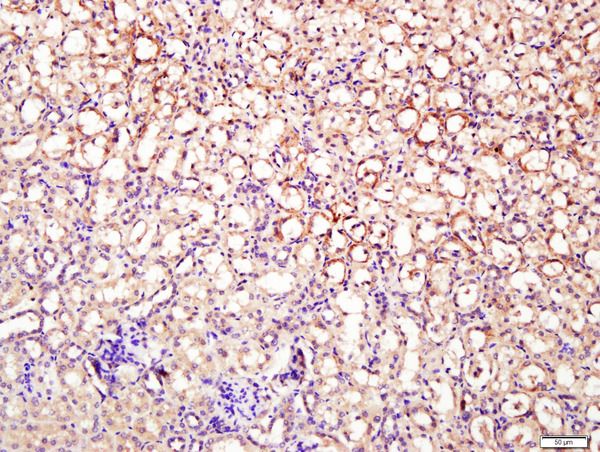 Paraformaldehyde-fixed, paraffin embedded mouse kidney tissue; Antigen retrieval by boiling in sodium citrate buffer(pH6) for 15min; Block endogenous peroxidase by 3% hydrogen peroxide for 30 minutes; Blocking buffer (normal goat serum) at 37°C for 20min; Antibody incubation with Rabbit Anti-DNase II Polyclonal Antibody, Unconjugated (bs-7652R) at 1:400 overnight at 4°C, followed by a conjugated secondary and DAB staining\\n