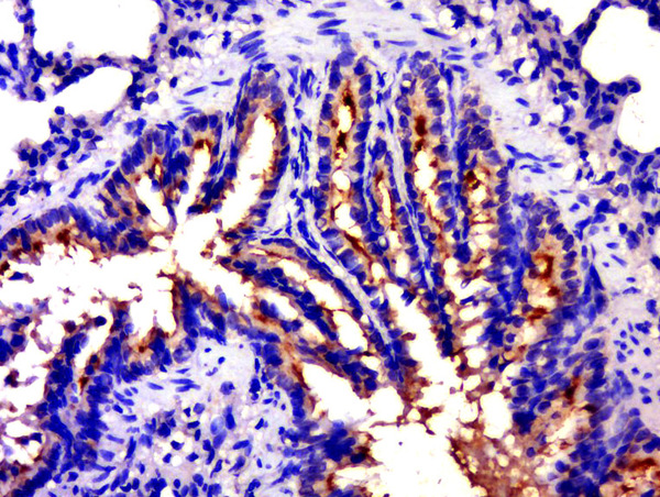 Paraformaldehyde-fixed, paraffin embedded rat lung tissue; Antigen retrieval by boiling in sodium citrate buffer(pH6) for 15min; Block endogenous peroxidase by 3% hydrogen peroxide for 30 minutes; Blocking buffer (normal goat serum) at 37°C for 20min; Antibody incubation with Rabbit Anti-EGFR5 Polyclonal Antibody, Unconjugated (bs-9813R) at 1:500 overnight at 4°C, followed by a conjugated secondary and DAB staining