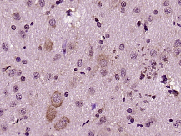 Paraformaldehyde-fixed, paraffin embedded rat brain; Antigen retrieval by boiling in sodium citrate buffer (pH6) for 15min; Block endogenous peroxidase by 3% hydrogen peroxide for 30 minutes; Blocking buffer (normal goat serum) at 37°C for 20min; Antibody incubation with FADD Polyclonal Antibody (bs-0511R) at 1:400 overnight at 4°C, followed by a conjugated secondary and DAB staining.