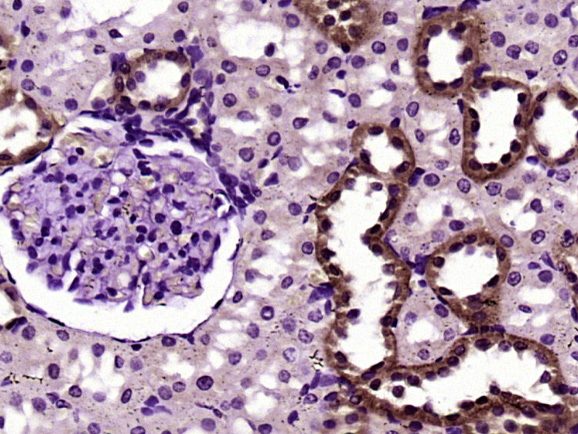 Paraformaldehyde-fixed, paraffin embedded rat kidney; Antigen retrieval by boiling in sodium citrate buffer (pH6) for 15min; Block endogenous peroxidase by 3% hydrogen peroxide for 30 minutes; Blocking buffer (normal goat serum) at 37°C for 20min; Antibody incubation with FADD Polyclonal Antibody (bs-0511R) at 1:400 overnight at 4°C, followed by a conjugated secondary and DAB staining.