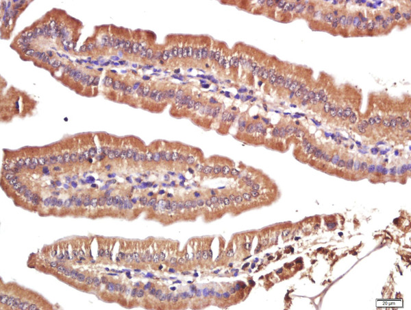 Paraformaldehyde-fixed, paraffin embedded mouse intestine; Antigen retrieval by boiling in sodium citrate buffer (pH6.0) for 15min; Block endogenous peroxidase by 3% hydrogen peroxide for 20 minutes; Blocking buffer (normal goat serum) at 37°C for 30min; Antibody incubation with FAM134C Polyclonal Antibody, Unconjugated (bs-8153R) at 1:400 overnight at 4°C, followed by a conjugated secondary for 20 minutes and DAB staining.