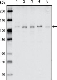 Western blot analysis using EhpB1 mouse mAb against MDA-MB-468 (1), MDA-MB-453 (2), MCF-7 (3), T47D (4) and SKBR-3 (5) cell lysate.