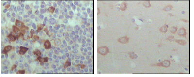 Immunohistochemical analysis of paraffin-embedded human lymph node (left) and brain (right), showing cytoplasmic localization with DAB staining using EhpB6 mouse mAb
