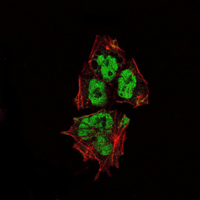 Immunofluorescence analysis of NTERA-2 cells using SOX2 mouse mAb (green). Red: Actin filaments have been labeled with Alexa Fluor-555 phalloidin