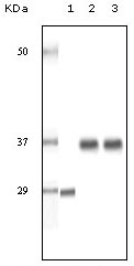Western blot analysis using SRA mouse mAb against truncated SRA recombinant protein (1), human ovary cancer tissue lysate (2) and A431 cell lysate (3)