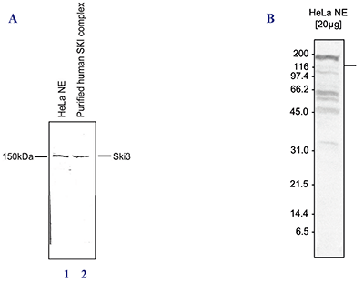 <strong> Figure 1. Western blot analysis using the Diagenode antibody directed against SKI3 </strong><br />Western blot was performed on HeLa nuclear extracts (lane 1) and on the purified human SKI complex (lane 2) (Figure 1A), or on nuclear extracts from HeLa cells (HeLa NE, 20 μg) (Figure 1B) using the Diagenode antibody against SKI3 (Cat. No. pAb-011-150) diluted 1:1,000. The location of the protein is indicated on the right, the marker (in kDa) is shown on the left.