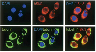 <strong> Figure 2. Immunofluorescence with the Diagenode antibody directed against SKI3 </strong><br />HeLa cells were stained with the Diagenode antibody against SKI3 (Cat. No. pAb-011-150) (in red), with DAPI to label the DNA (in blue), and with an antibody against α-tubulin to label the cytoplasm (in green). SKI3 is detected in both the cytoplasm and the nucleus but appears to be excluded from the nucleolus.