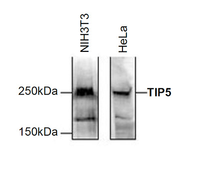 <strong> Figure 2. Western blot analysis using the Diagenode antibody directed against TIP5 </strong><br />Western blot was performed on 150 μg nuclear extract from either NIH3T3 or HeLa cells with the Diagenode antibody against TIP5 (cat. No. CS-090-100), diluted 1:1,000 in PBS containing 5% milk powder and 0.1% Tween- 20. The molecular weight marker is shown on the left, the location of the protein of interest is indicated on the right.