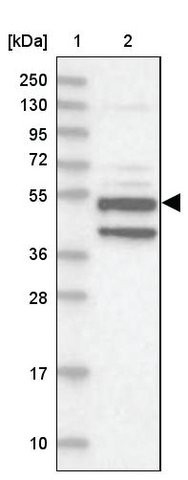 <B>Immunoblotting</B><BR/>Anti-XYLB: <B>Cat. No. HPA037863</B>: <BR/><B>Lane</B><BR/>1. Marker [kDa] 250, 130, 95, 72, 55, 36, 28, 17, 10<BR/>2. Human cell line RT-4