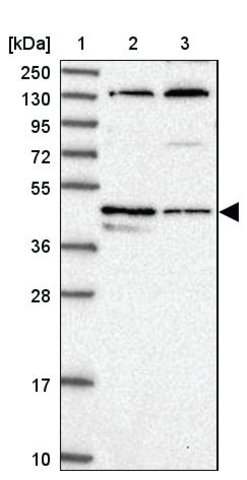 <B>Immunoblotting</B><BR/>Anti-C14orf80: <B>Cat. No. HPA039050</B>: <BR/><B>Lane</B><BR/>1. Marker [kDa] 250, 130, 95, 72, 55, 36, 28, 17, 10<BR/>2. Human cell line RT-4<BR/>3. Human cell line U-251 MG sp