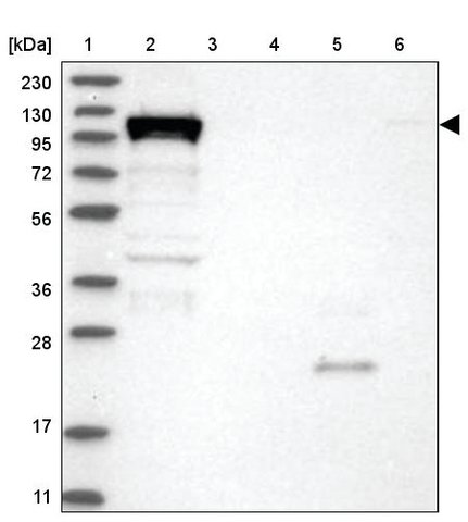 <B>Immunoblotting</B><BR/>Anti-DHX36: <B>Cat. No. HPA035399</B>: <BR/><B>Lane</B><BR/>1. Marker [kDa] 230, 130, 95, 72, 56, 36, 28, 17, 11<BR/>2. Human cell line RT-4<BR/>3. Human cell line U-251 MG sp<BR/>4. Human plasma (IgG/HSA depleted)<BR/>5. Human liver tissue<BR/>6. Human tonsil tissue
