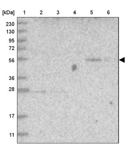 <B>Immunoblotting</B><BR/>Anti-FAM98A: <B>Cat. No. HPA036251</B>: <BR/><B>Lane</B><BR/>1. Marker [kDa] 230, 130, 95, 72, 56, 36, 28, 17, 11<BR/>2. Human cell line RT-4<BR/>3. Human cell line U-251 MG sp<BR/>4. Human plasma (IgG/HSA depleted)<BR/>5. Human liver tissue<BR/>6. Human tonsil tissue