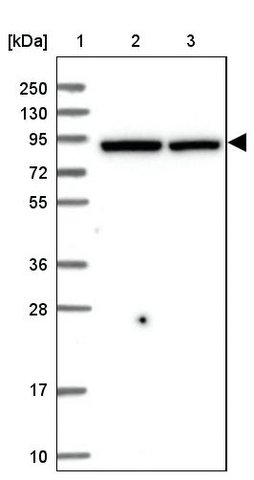<B>Immunoblotting</B><BR/>Anti-QARS: <B>Cat. No. HPA036986</B>: <BR/><B>Lane</B><BR/>1. Marker [kDa] 250, 130, 95, 72, 55, 36, 28, 17, 10<BR/>2. Human cell line RT-4<BR/>3. Human cell line U-251 MG sp