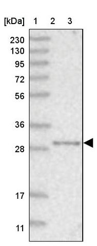 <B>Immunoblotting</B><BR/>Anti-NIT2: <B>Cat. No. HPA036999</B>: <BR/><B>Lane</B><BR/>1. Marker [kDa] 230, 130, 95, 72, 56, 36, 28, 17, 11<BR/>2. Human cell line RT-4<BR/>3. Human plasma (IgG/HSA depleted)