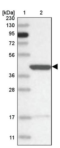 <B>Immunoblotting</B><BR/>Anti-INPP1: <B>Cat. No. HPA036698</B>: <BR/><B>Lane</B><BR/>1. Marker [kDa] 230, 130, 95, 72, 56, 36, 28, 17, 11<BR/>2. Human cell line RT-4