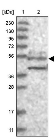 <B>Immunoblotting</B><BR/>Anti-WDR37: <B>Cat. No. HPA037565</B>: <BR/><B>Lane</B><BR/>1. Marker [kDa] 230, 130, 95, 72, 56, 36, 28, 17, 11<BR/>2. Human cell line RT-4
