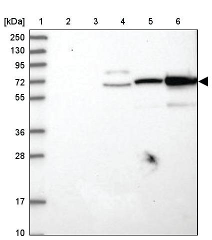 <B>Immunoblotting</B><BR/>Anti-LRRC24: <B>Cat. No. HPA037689</B>: <BR/><B>Lane</B><BR/>1. Marker [kDa] 250, 130, 95, 72, 55, 36, 28, 17, 10<BR/>2. Human cell line RT-4<BR/>3. Human cell line U-251 MG sp<BR/>4. Human plasma (IgG/HSA depleted)<BR/>5. Human liver tissue<BR/>6. Human tonsil tissue
