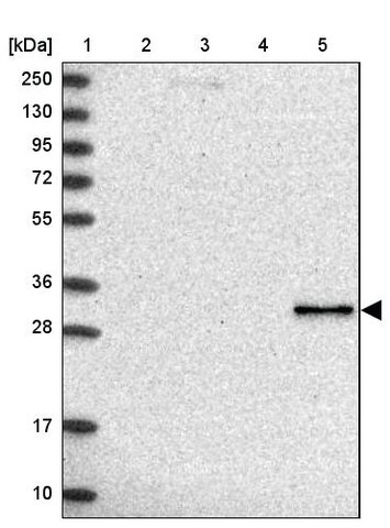 <B>Immunoblotting</B><BR/>Anti-RDH16: <B>Cat. No. HPA038518</B>: <BR/><B>Lane</B><BR/>1. Marker [kDa] 250, 130, 95, 72, 55, 36, 28, 17, 10<BR/>2. Human cell line RT-4<BR/>3. Human cell line U-251 MG sp<BR/>4. Human plasma (IgG/HSA depleted)<BR/>5. Human liver tissue