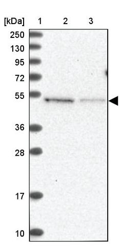 <B>Immunoblotting</B><BR/>Anti-MSANTD2: <B>Cat. No. HPA038695</B>: <BR/><B>Lane</B><BR/>1. Marker [kDa] 250, 130, 95, 72, 55, 36, 28, 17, 10<BR/>2. Human cell line RT-4<BR/>3. Human cell line U-251 MG sp