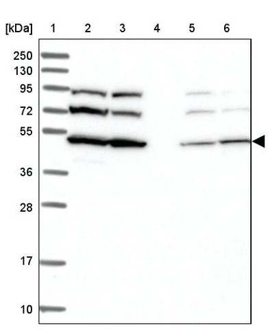 <B>Immunoblotting</B><BR/>Anti-SLC46A3: <B>Cat. No. HPA039930</B>: <BR/><B>Lane</B><BR/>1. Marker [kDa] 250, 130, 95, 72, 55, 36, 28, 17, 10<BR/>2. Human cell line RT-4<BR/>3. Human cell line U-251 MG sp<BR/>4. Human plasma (IgG/HSA depleted)<BR/>5. Human liver tissue<BR/>6. Human tonsil tissue