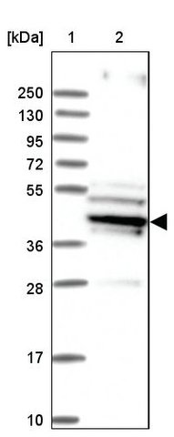 <B>Immunoblotting</B><BR/>Anti-SUCLA2: <B>Cat. No. HPA039435</B>: <BR/><B>Lane</B><BR/>1. Marker [kDa] 250, 130, 95, 72, 55, 36, 28, 17, 10<BR/>2. Human cell line RT-4