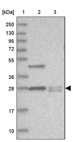 <B>Immunoblotting</B><BR/>Anti-THYN1: <B>Cat. No. HPA038732</B>: <BR/><B>Lane</B><BR/>1. Marker [kDa] 250, 130, 95, 72, 55, 36, 28, 17, 10<BR/>2. Human cell line RT-4<BR/>3. Human cell line U-251 MG sp