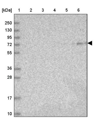 <B>Immunoblotting</B><BR/>Anti-ARSJ: <B>Cat. No. HPA036482</B>: <BR/><B>Lane</B><BR/>1. Marker [kDa] 250, 130, 95, 72, 55, 36, 28, 17, 10<BR/>2. Human cell line RT-4<BR/>3. Human cell line U-251 MG sp<BR/>4. Human plasma (IgG/HSA depleted)<BR/>5. Human liver tissue<BR/>6. Human tonsil tissue