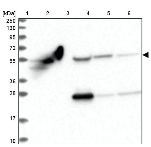 <B>Immunoblotting</B><BR/>Anti-OTUD1: <B>Cat. No. HPA038504</B>: <BR/><B>Lane</B><BR/>1. Marker [kDa] 250, 130, 95, 72, 55, 36, 28, 17, 10<BR/>2. Human cell line RT-4<BR/>3. Human cell line U-251 MG sp<BR/>4. Human plasma (IgG/HSA depleted)<BR/>5. Human liver tissue<BR/>6. Human tonsil tissue